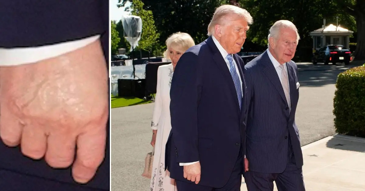 Trump's Odd Hand Moment at Royal Visit Has Internet Buzzing — What's Really Going On?