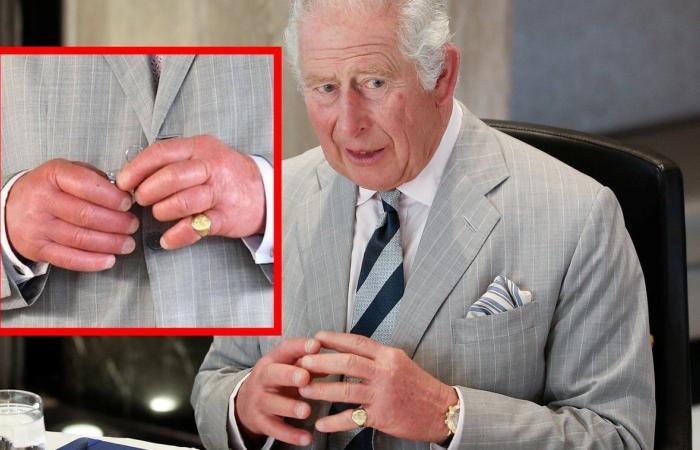 How Sick is Charles Really? New Symptom Can't be Ignored!
