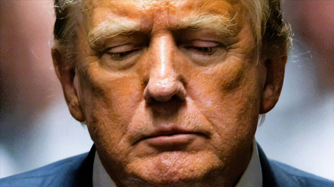 Trump explains reason for bruise on hand after new pictures spark concern